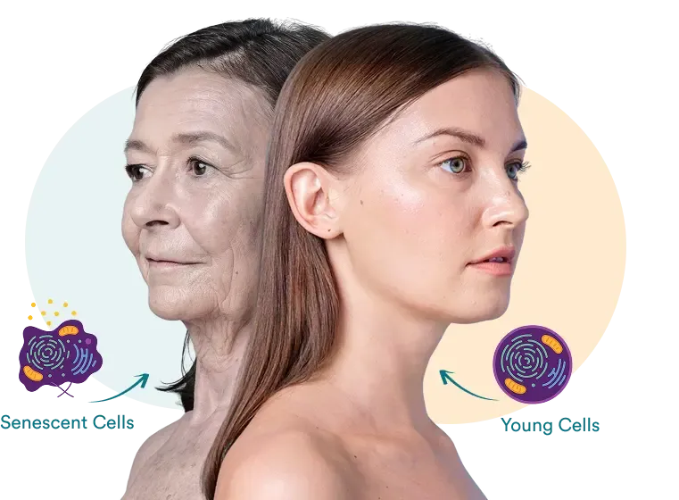 Senescent Cells: The Zombies Eating Your Skin From Within