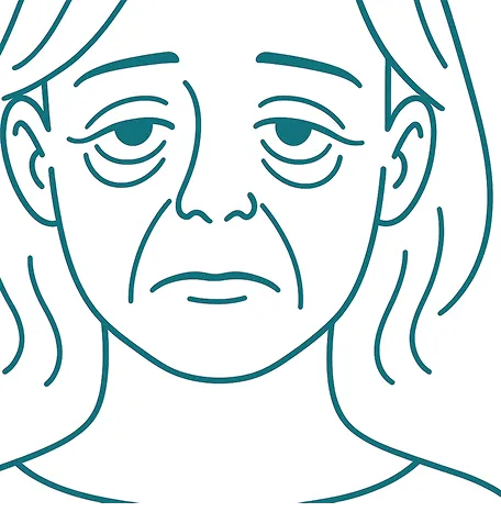 Woman with sagging eyes