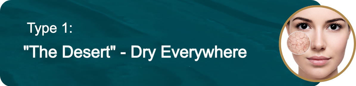 Type 1: "The Desert" - Dry Everywhere